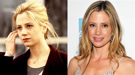 Mira Sorvino Plastic Surgery Before & After